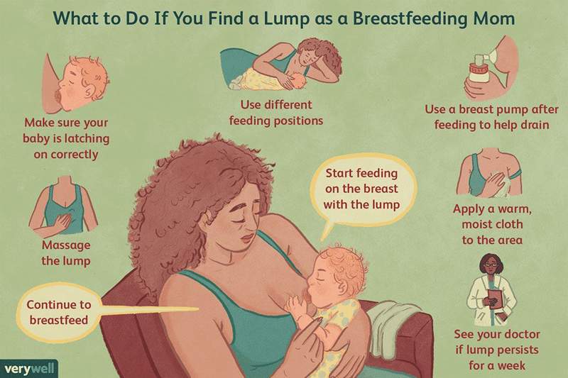 Que faire si vous trouvez une bosse de mammaire pendant l'allaitement
